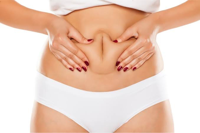 How to Remove Belly Fat Without Surgery