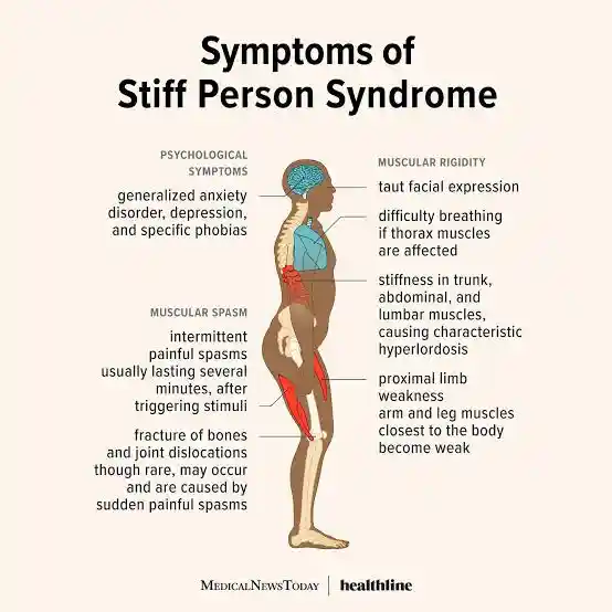 Celine Dion, Symptoms ofStiff Person Syndrome, Stiff-Person Syndrome